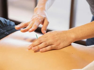 Akupunktura a mozgásszervi panaszok enyhítésében – Akupunkturbehandlungen usw