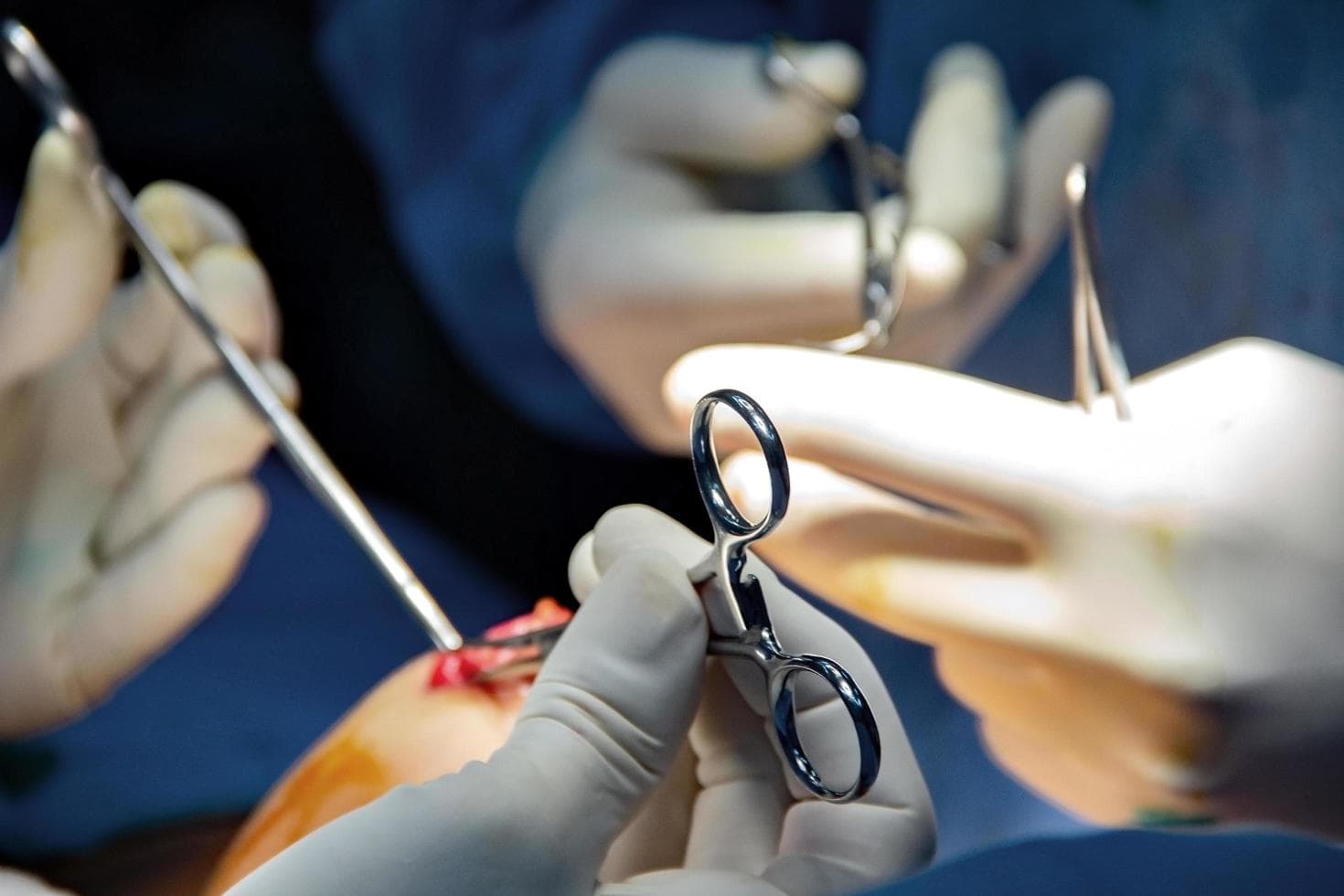 Warum eine Brustvergrößerung mit Straffung in der modernen Chirurgie bevorzugt wird